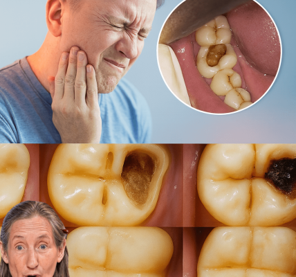 😁 Smile Bright Naturally: Simple Tips to Keep Your Teeth Healthy and Avoid Extra Dental Visits!