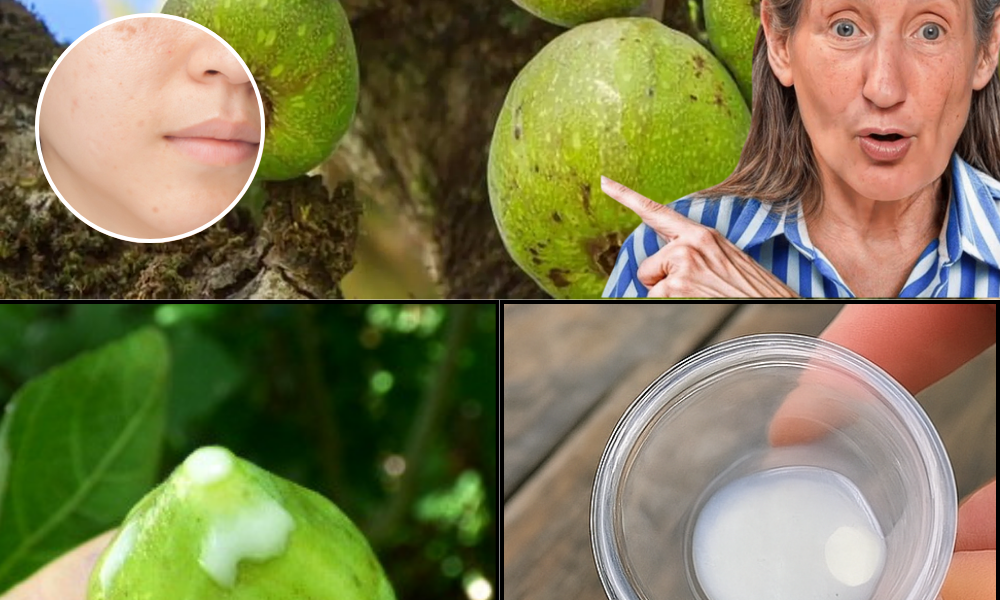 The Gentle Magic of Fig Sap: Rediscover Nature’s Hidden Remedy The Gentle Magic of Fig Sap: Rediscover Nature’s Hidden Remedy