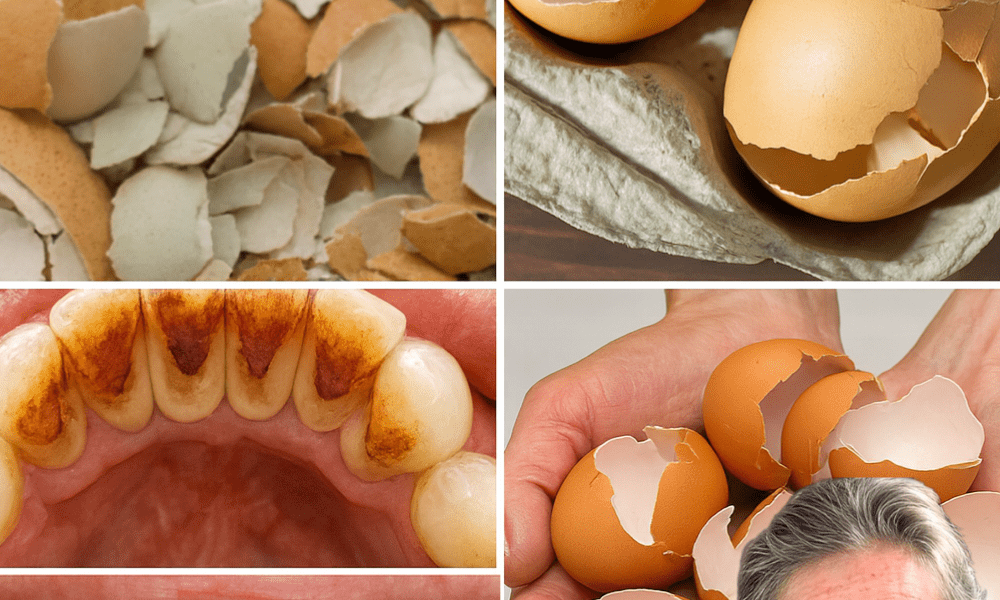 Transform Your Smile Naturally: The Eggshell Secret to Dazzling White Teeth Transform Your Smile Naturally: The Eggshell Secret to Dazzling White Teeth