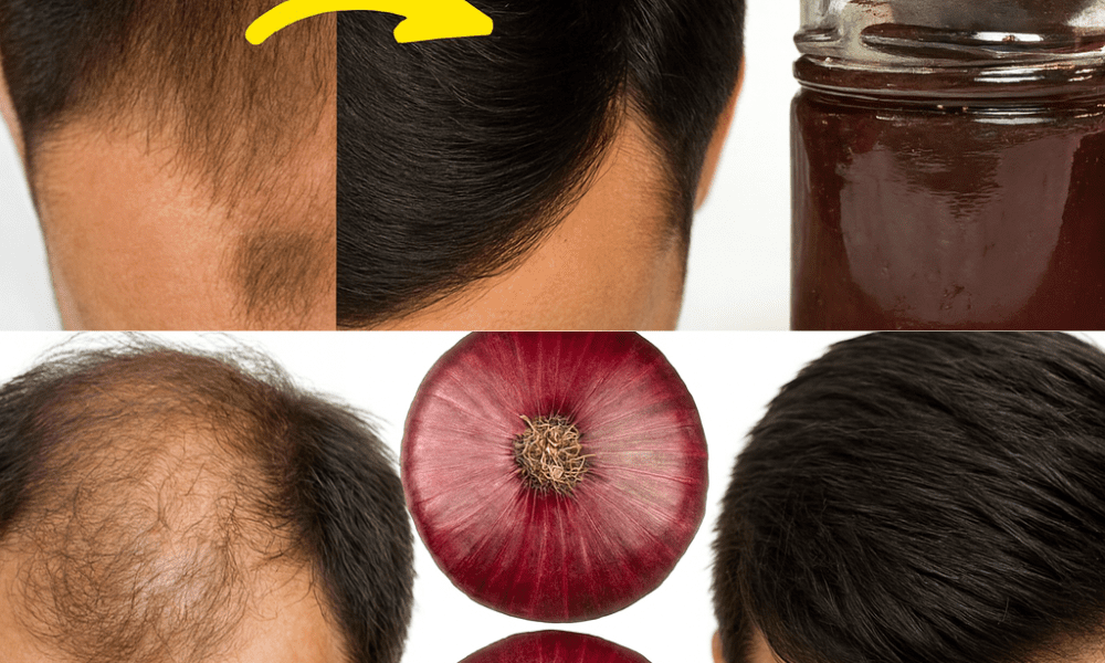 Red Onion for Hair Growth: Unlock the Secret to Thicker, Stronger Hair Red Onion for Hair Growth: Unlock the Secret to Thicker, Stronger Hair