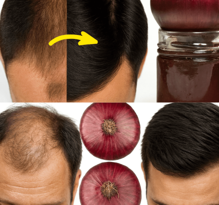 Red Onion for Hair Growth: Unlock the Secret to Thicker, Stronger Hair Red Onion for Hair Growth: Unlock the Secret to Thicker, Stronger Hair