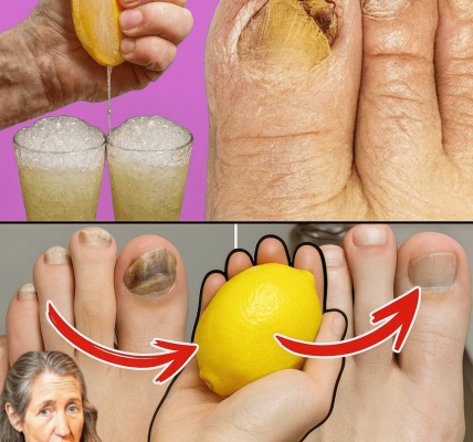 Banish Toenail Fungus Naturally: The Lemon and Garlic Secret You Need to Know Banish Toenail Fungus Naturally: The Lemon and Garlic Secret You Need to Know