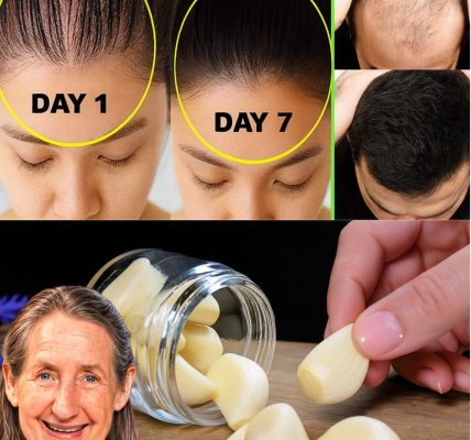 Miracle Hair Growth Oil: Transform Your Hair with Just 3 Natural Ingredients Miracle Hair Growth Oil: Transform Your Hair with Just 3 Natural Ingredients