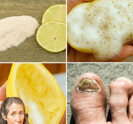 š Discover the Secret to Banishing Nail Fungus Naturally with Lemon and Salt š Discover the Secret to Banishing Nail Fungus Naturally with Lemon and Salt