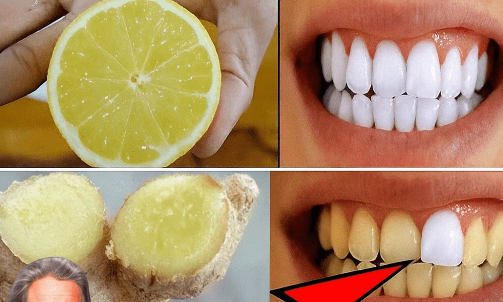 ✨ Discover the Secret to a Dazzling Smile: Ginger and Baking Soda Magic ✨ Discover the Secret to a Dazzling Smile: Ginger and Baking Soda Magic