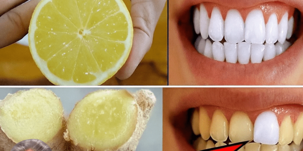✨ Discover the Secret to a Dazzling Smile: Ginger and Baking Soda Magic ✨ Discover the Secret to a Dazzling Smile: Ginger and Baking Soda Magic