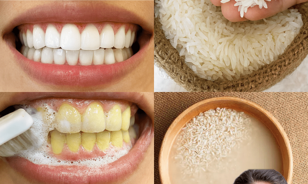 Sparkle in Seconds: The Ultimate 1-Minute Teeth Whitening Secret You’ll Wish You Knew Sooner! Sparkle in Seconds: The Ultimate 1-Minute Teeth Whitening Secret You’ll Wish You Knew Sooner!