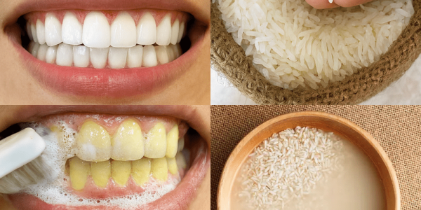 Sparkle in Seconds: The Ultimate 1-Minute Teeth Whitening Secret Youāll Wish You Knew Sooner! Sparkle in Seconds: The Ultimate 1-Minute Teeth Whitening Secret Youāll Wish You Knew Sooner!