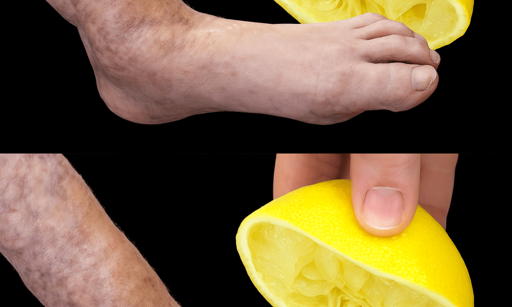 🍋 Mom’s Secret Lemon Remedy: Your All-Natural Cure for Pain and Discomfort 🍋 Mom’s Secret Lemon Remedy: Your All-Natural Cure for Pain and Discomfort