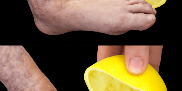 🍋 Mom’s Secret Lemon Remedy: Your All-Natural Cure for Pain and Discomfort