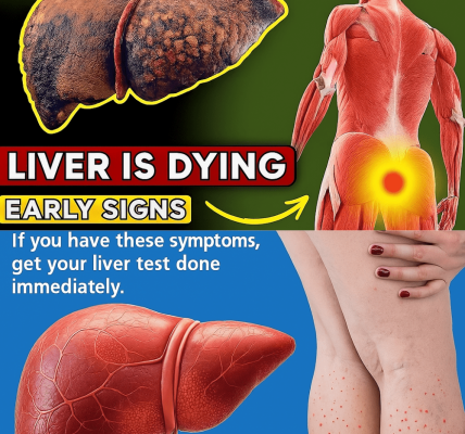 Is Your Liver Sending You a Warning? 12 Subtle Signs of Cirrhosis You Can’t Afford to Ignore Is Your Liver Sending You a Warning? 12 Subtle Signs of Cirrhosis You Can’t Afford to Ignore