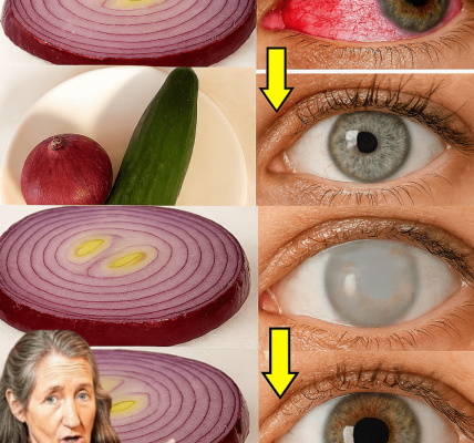 Can Onions Really Sharpen Your Vision in Just 5 Days? The Surprising Truth Unveiled š§
šļø Can Onions Really Sharpen Your Vision in Just 5 Days? The Surprising Truth Unveiled š§
šļø