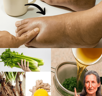 Unlock the Secret to Banishing Leg Swelling Naturally: The Power of Parsley, Dandelion Root, Lemon, and Ginger Unlock the Secret to Banishing Leg Swelling Naturally: The Power of Parsley, Dandelion Root, Lemon, and Ginger