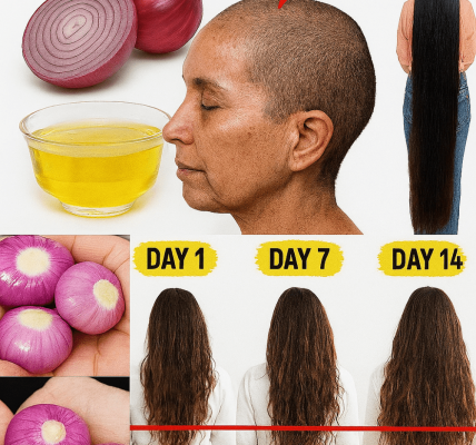 Unveiling the Secret of Onion Hair Oil: A Miracle for Hair Growth? Unveiling the Secret of Onion Hair Oil: A Miracle for Hair Growth?
