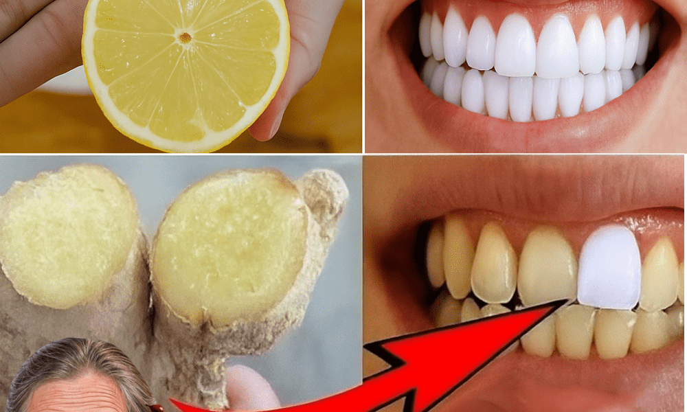 Unlock a Radiant Smile Naturally: The Surprising Power of Ginger and Baking Soda for Whiter Teeth and Fresher Breath Unlock a Radiant Smile Naturally: The Surprising Power of Ginger and Baking Soda for Whiter Teeth and Fresher Breath
