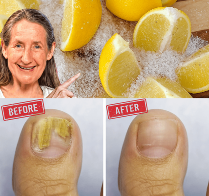 🌟 Unveil the Secret to Stunning Nails: The Ultimate 100% Natural Toenail Fungus Remedy 🌟 Unveil the Secret to Stunning Nails: The Ultimate 100% Natural Toenail Fungus Remedy