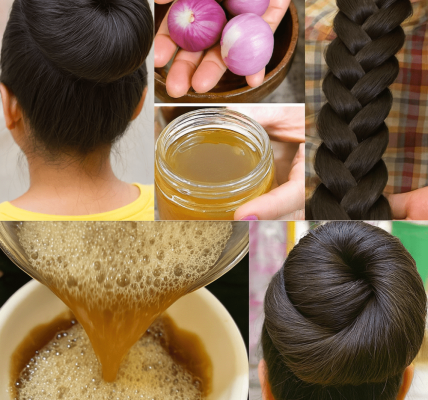 🌿 From Mockery to Marvel: The Onion Oil Hair Revolution 🌿 From Mockery to Marvel: The Onion Oil Hair Revolution