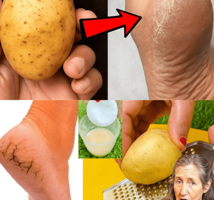 🥔 Transform Your Cracked Heels with Potatoes: The Surprising Secret You’ll Wish You Tried Sooner 🥔 Transform Your Cracked Heels with Potatoes: The Surprising Secret You’ll Wish You Tried Sooner