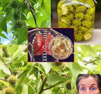 American Sweetgum (Liquidambar styraciflua): Health Benefits and Easy Ways to Use It at Home