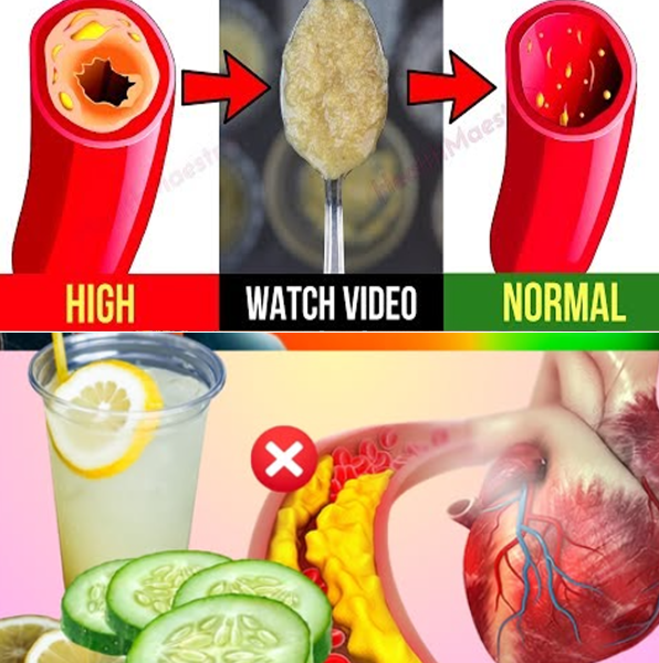 10 Vegetables That Help Keep Arteries Clean — Naturally! 10 Vegetables That Help Keep Arteries Clean — Naturally!