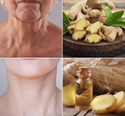 Ginger: A Natural Secret for Youthful Skin! Ginger: A Natural Secret for Youthful Skin!