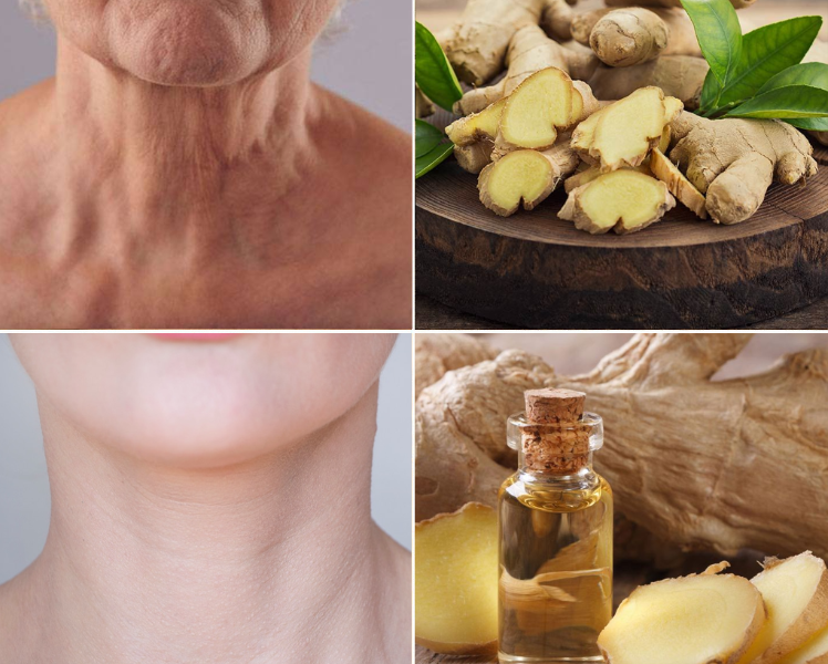 Ginger: A Natural Secret for Youthful Skin! Ginger: A Natural Secret for Youthful Skin!