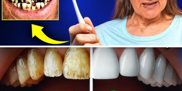 Naturally Reverse Early Tooth Decay: 6 Proven Tips to Strengthen Enamel and Support Your Smile