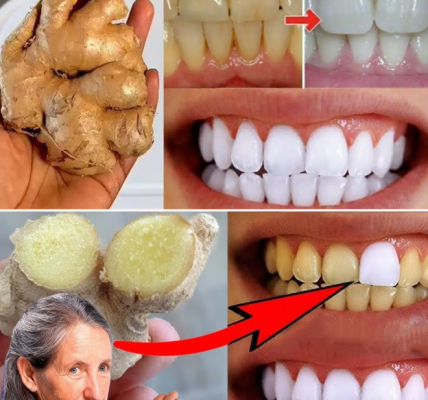 Whiten Your Teeth and Instantly Freshen Your Breath with the Natural Power of Ginger and Baking Soda Whiten Your Teeth and Instantly Freshen Your Breath with the Natural Power of Ginger and Baking Soda