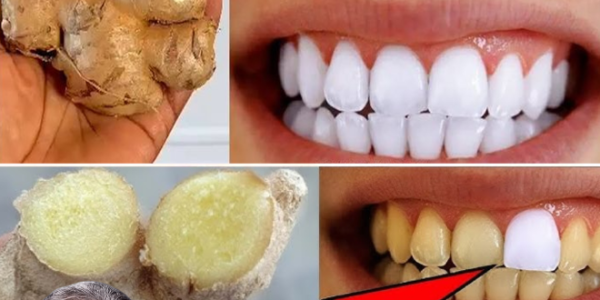 Whiten Your Teeth and Instantly Freshen Your Breath with the Natural Power of Ginger and Baking Soda
