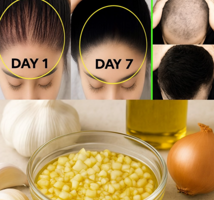 Hair Grows Faster and Falls Less with This Natural 3-Ingredient Remedy – Backed by Tradition and Loved by Modern Wellness Experts Hair Grows Faster and Falls Less with This Natural 3-Ingredient Remedy – Backed by Tradition and Loved by Modern Wellness Experts