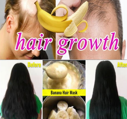 Hair Thinning? Try This Unique Combo to Support Hair Growth Naturally Hair Thinning? Try This Unique Combo to Support Hair Growth Naturally