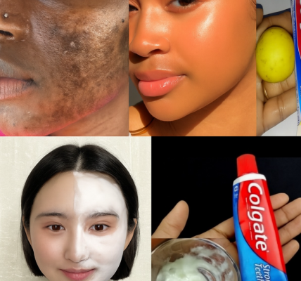 Colgate Toothpaste for Face Whitening: The Truth Behind the Lemon and Colgate Combo Colgate Toothpaste for Face Whitening: The Truth Behind the Lemon and Colgate Combo