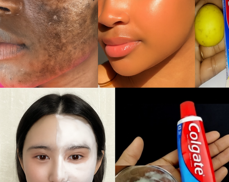 Colgate Toothpaste for Face Whitening: The Truth Behind the Lemon and Colgate Combo Colgate Toothpaste for Face Whitening: The Truth Behind the Lemon and Colgate Combo