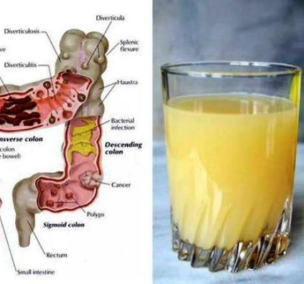 Can a Glass of Kefir Every Day Really Soothe Your Gut? Try and See Can a Glass of Kefir Every Day Really Soothe Your Gut? Try and See