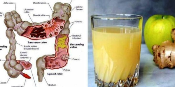 Can a Glass of Kefir Every Day Really Soothe Your Gut? Try and See
