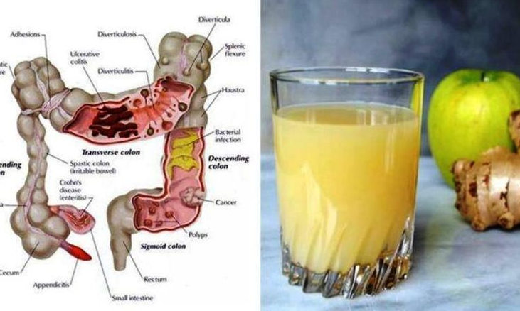Can a Glass of Kefir Every Day Really Soothe Your Gut? Try and See Can a Glass of Kefir Every Day Really Soothe Your Gut? Try and See