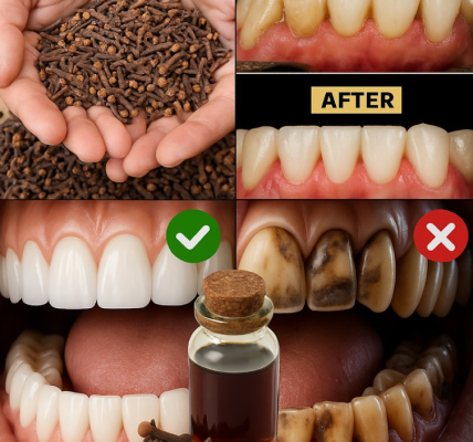 Clove Essential Oil for Pearly White Teeth: A Natural Two-Minute Formula Clove Essential Oil for Pearly White Teeth: A Natural Two-Minute Formula