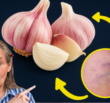 Can Garlic Support Healthier Veins Naturally? Can Garlic Support Healthier Veins Naturally?