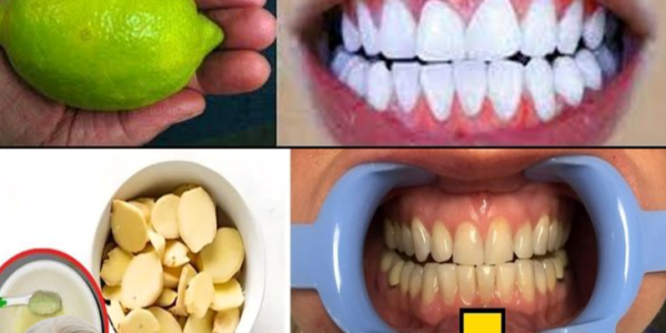 Natural Oral Care for Seniors: How Ginger and Lemon May Support a Brighter Smile Over Time