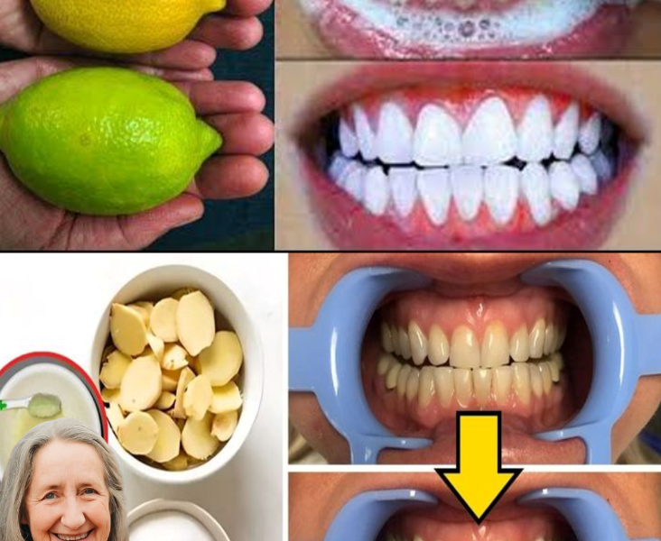 Natural Oral Care for Seniors: How Ginger and Lemon May Support a Brighter Smile Over Time Natural Oral Care for Seniors: How Ginger and Lemon May Support a Brighter Smile Over Time