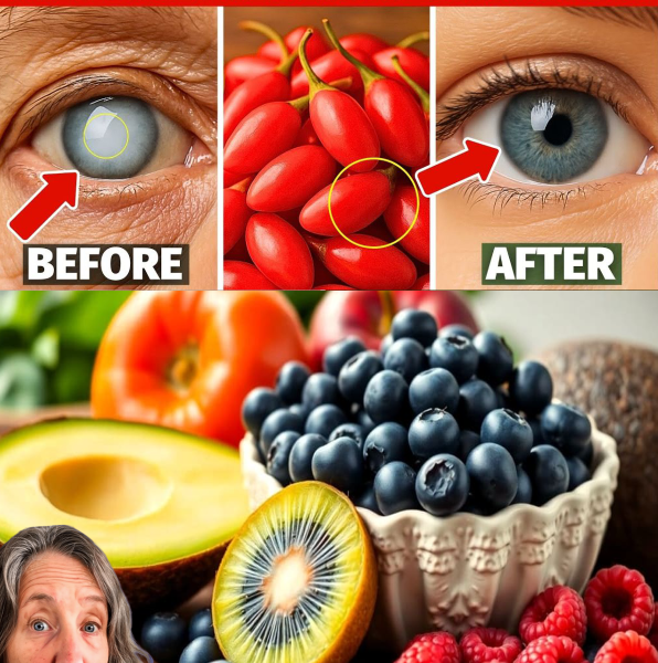 Cataracts? Eat These 5 Fruits to Support Clearer Vision Naturally Cataracts? Eat These 5 Fruits to Support Clearer Vision Naturally