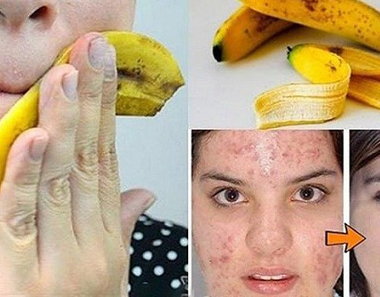 Banana Peel Anti-Aging Mask: A Natural Secret for Radiant Skin