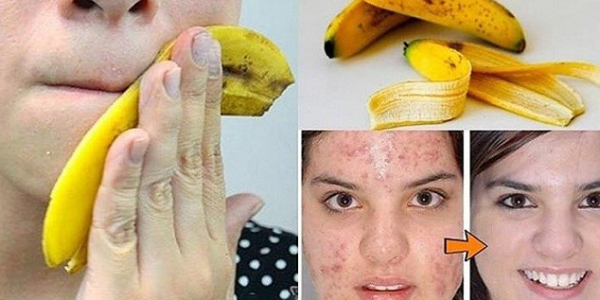 Banana Peel Anti-Aging Mask: A Natural Secret for Radiant Skin