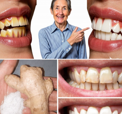 The Secret Duo in Your Kitchen That Dentists Rarely Talk About: How Ginger and Baking Soda Can Erase Plaque and Brighten Your Smile Naturally The Secret Duo in Your Kitchen That Dentists Rarely Talk About: How Ginger and Baking Soda Can Erase Plaque and Brighten Your Smile Naturally