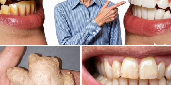 The Secret Duo in Your Kitchen That Dentists Rarely Talk About: How Ginger and Baking Soda Can Erase Plaque and Brighten Your Smile Naturally