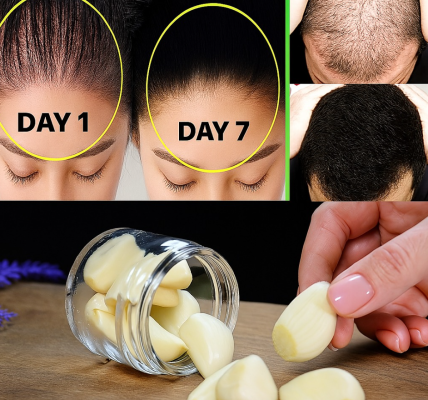Hair Grows Like Crazy and Stops Falling Out – The Best Natural Remedy with Just 3 Powerful Ingredients! Hair Grows Like Crazy and Stops Falling Out – The Best Natural Remedy with Just 3 Powerful Ingredients!