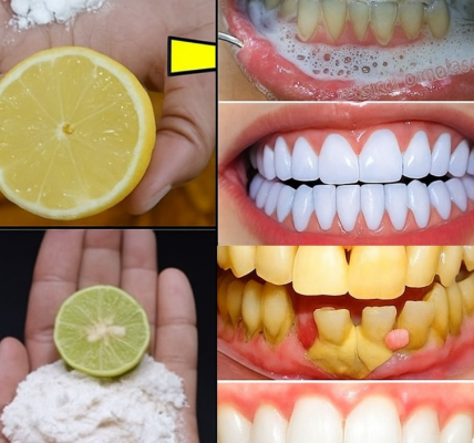 Unlock the Secret to a Dazzling Smile: The Baking Soda and Lemon Power Duo You Need to Try! Unlock the Secret to a Dazzling Smile: The Baking Soda and Lemon Power Duo You Need to Try!