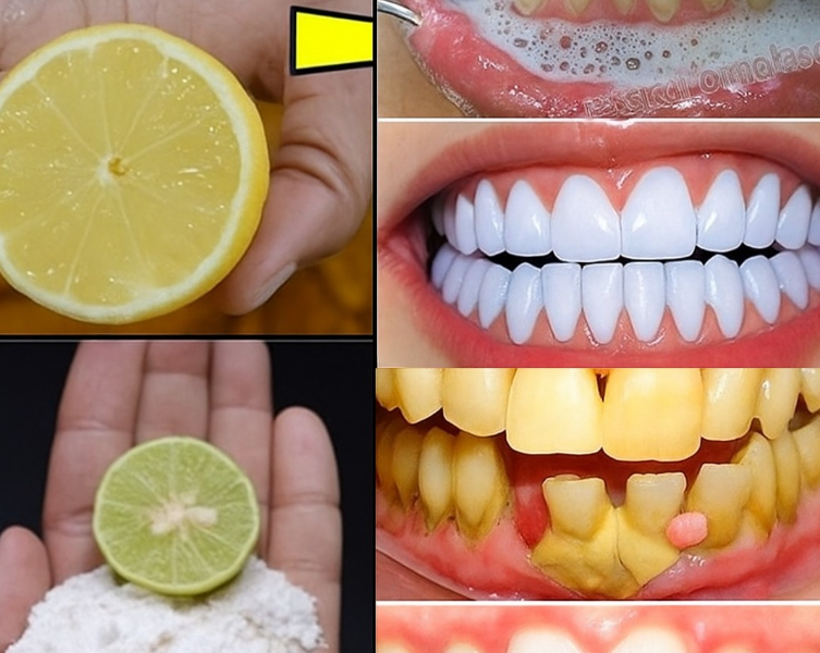 Unlock the Secret to a Dazzling Smile: The Baking Soda and Lemon Power Duo You Need to Try! Unlock the Secret to a Dazzling Smile: The Baking Soda and Lemon Power Duo You Need to Try!