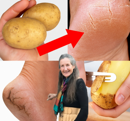 Say Goodbye to Cracked Heels: The Potato Trick for Smoother Feet Say Goodbye to Cracked Heels: The Potato Trick for Smoother Feet