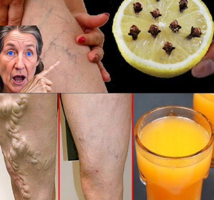 Mom’s Natural Remedy with Lemon: A Modern Approach to Pain and Inflammation Relief Mom’s Natural Remedy with Lemon: A Modern Approach to Pain and Inflammation Relief